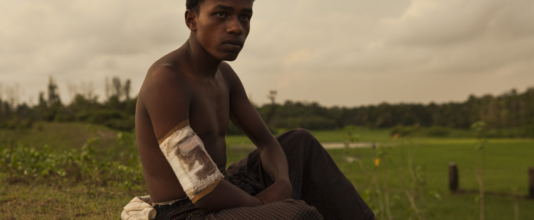 Ahammed Ullah is 20 years old from Saitaburuikka, Maungdaw he was shot in the arm when the Burmese military attacked his village. More than 270,000 Rohingya refugees have fled across the border from Rakhine State, Myanmar, into Bangladesh since 25 August. As many as 80 per cent of them are women and children. Many more children in need of support and protection remain in the areas of northern Rakhine State that have been wracked by violence.