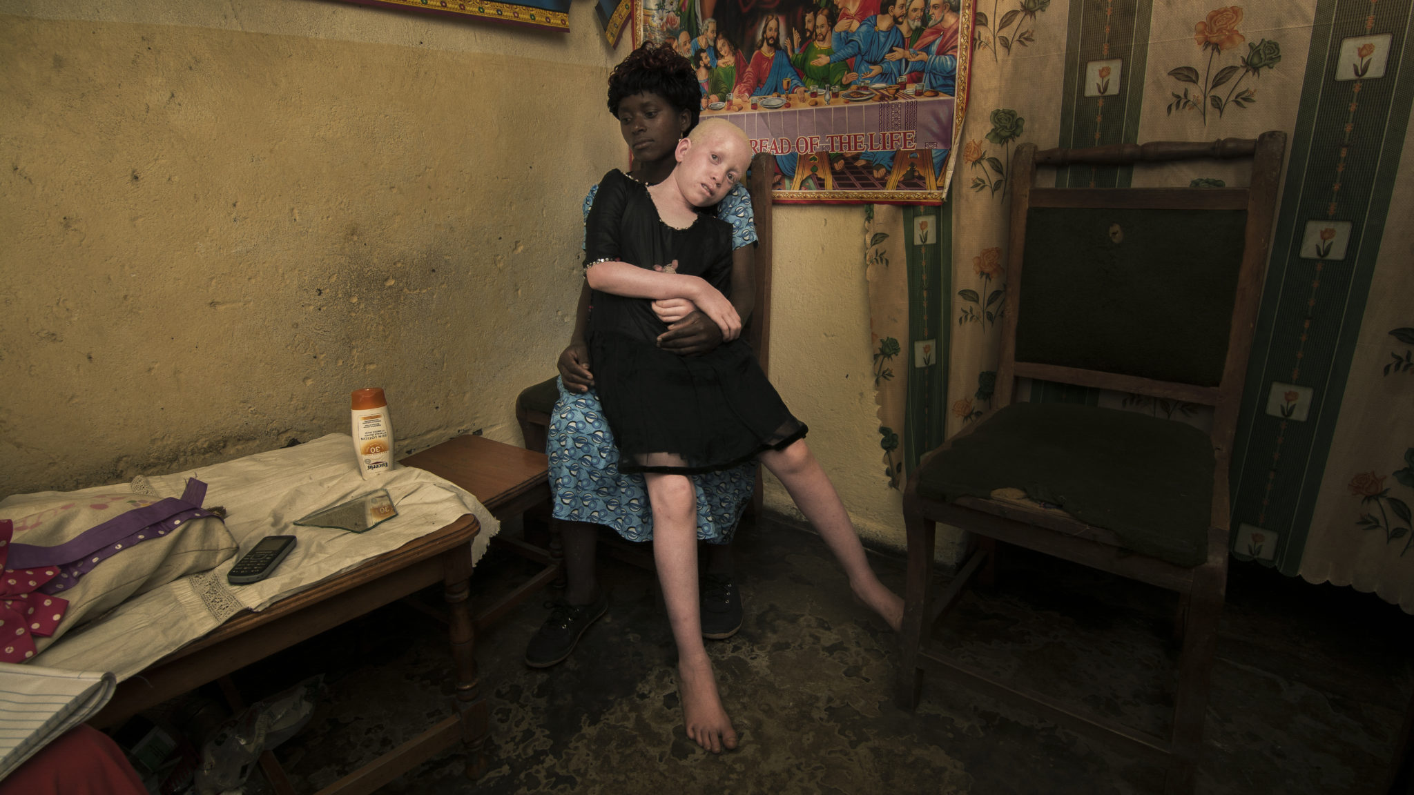 Malawi: Impunity fuels killings of people with albinism for their body parts